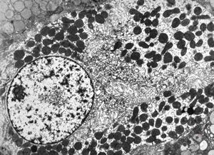 normal mucosa - stomach - parietal cell normal mucosa - stomach - parietal cell